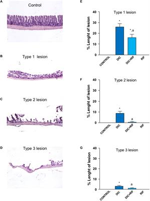 Pathophysiology of NSAID-Associated Intestinal Lesions in the Rat: Luminal Bacteria and Mucosal Inflammation as Targets for Prevention